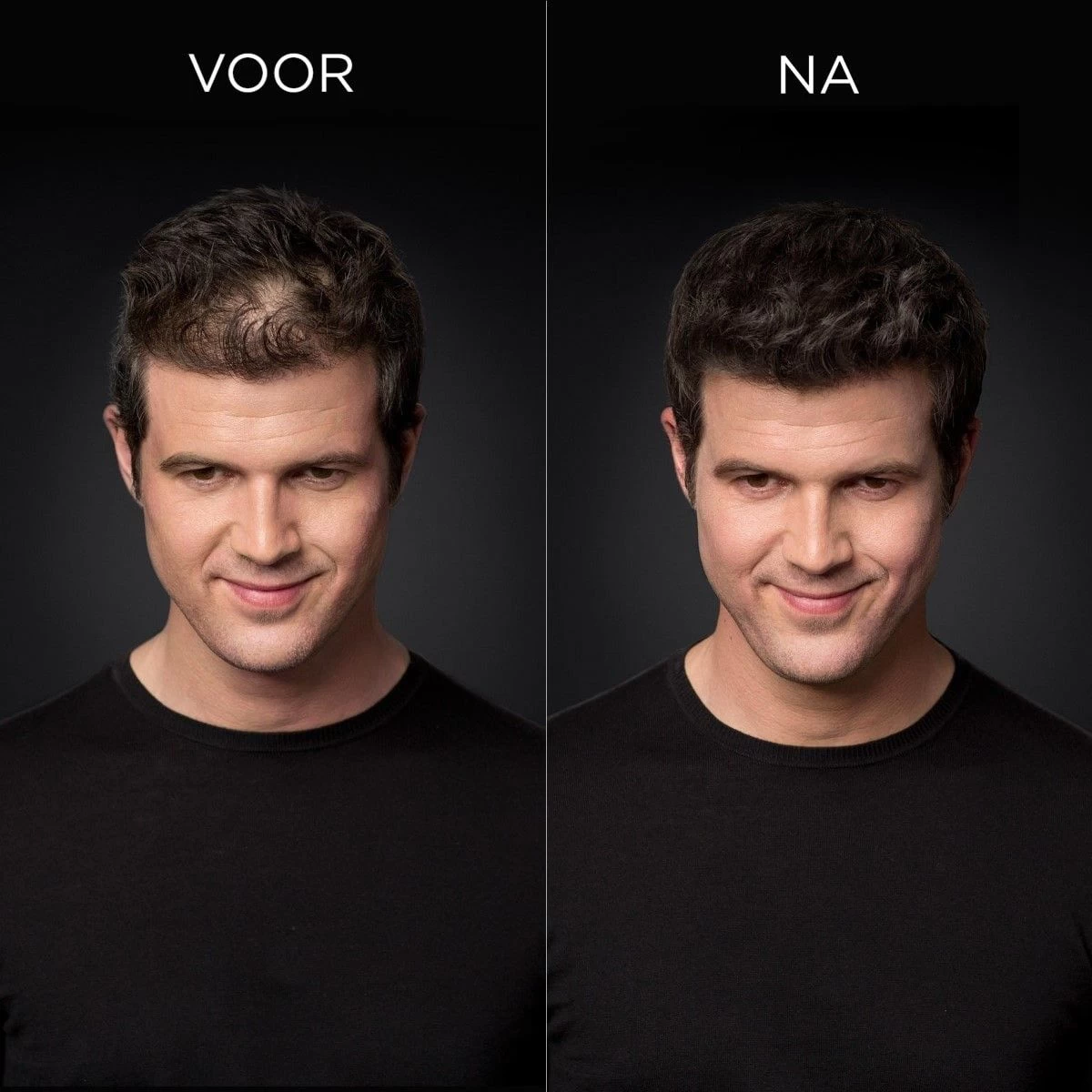 Toppik Colored Thickener Light Brown 144gr 4 Toppik Colored Thickener Light Brown 144gr - Afbeelding 2